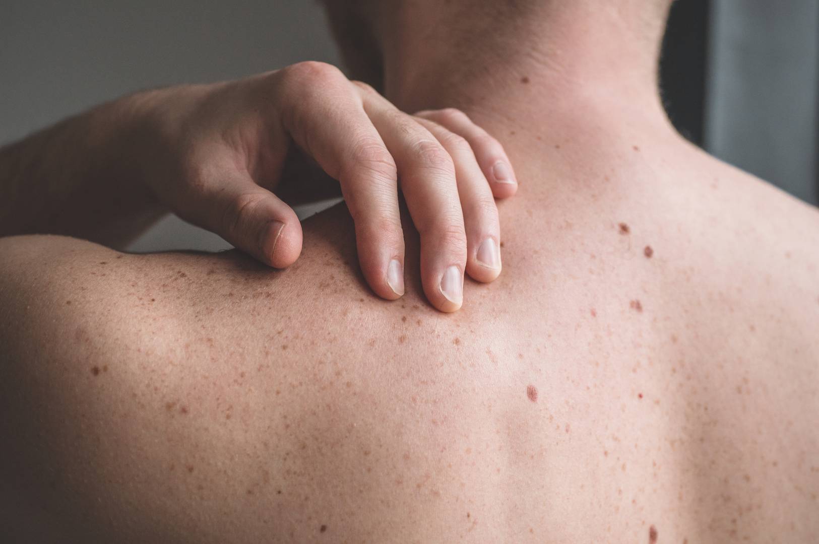 Brisbane Skin Doctors & Laser Centre